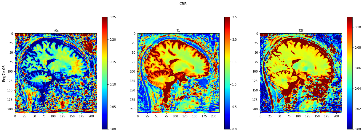 ../../../../_images/tutorials_notebooks_test_data_plot_TMI_paper_plot_testing_invivo_11_0.png