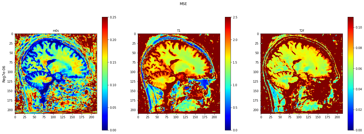 ../../../../_images/tutorials_notebooks_test_data_plot_TMI_paper_plot_testing_invivo_11_1.png