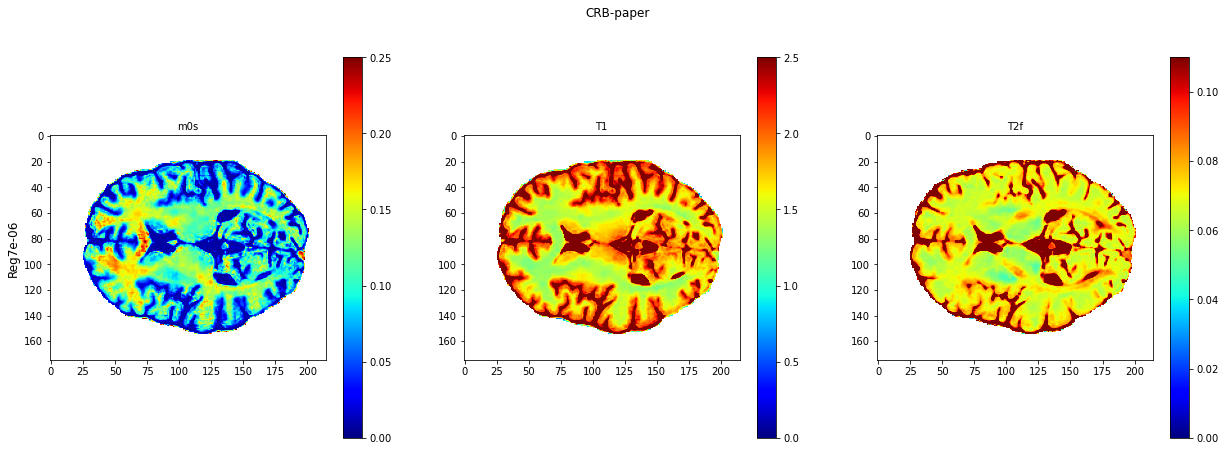 ../../../../_images/tutorials_notebooks_test_data_plot_TMI_paper_plot_testing_invivo_7_1.png