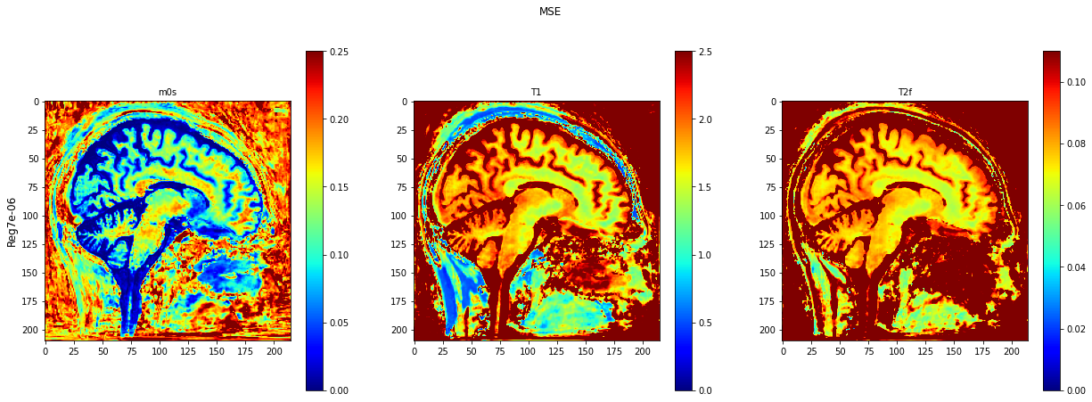 ../../../../_images/tutorials_notebooks_test_data_plot_TMI_paper_plot_testing_invivo_9_1.png